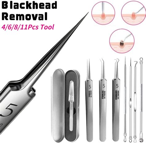 tweezers for blackheads|More.